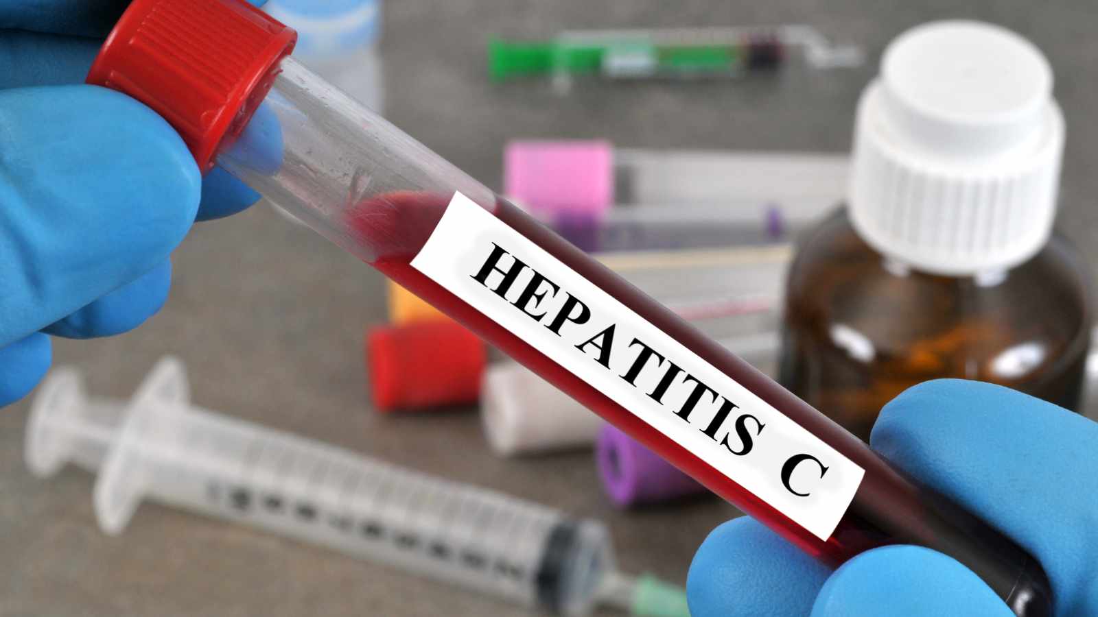 Blood sample labelled Hepatitis c