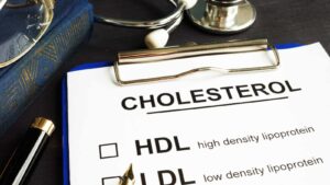 Cholesterol