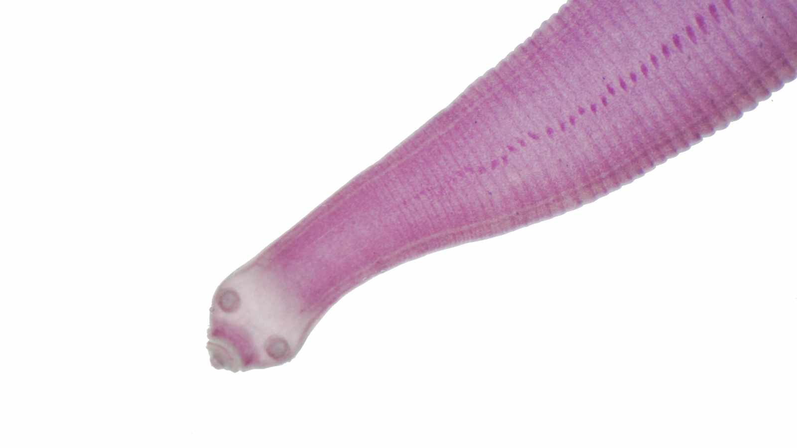 tape worm