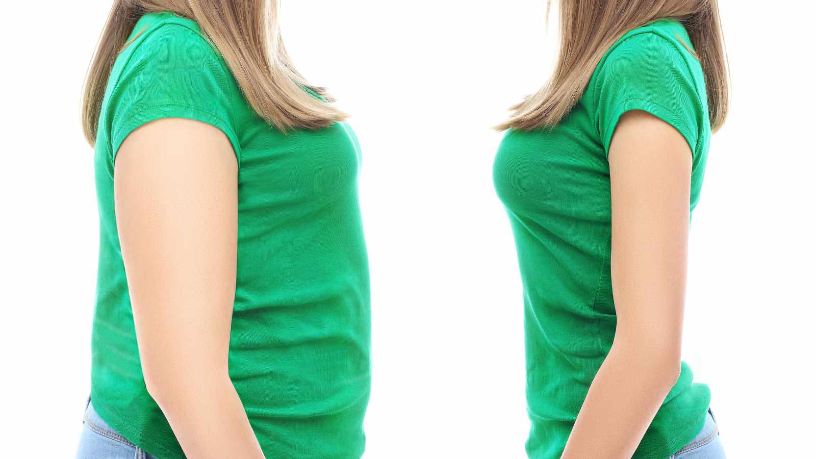 Before and after weight loss