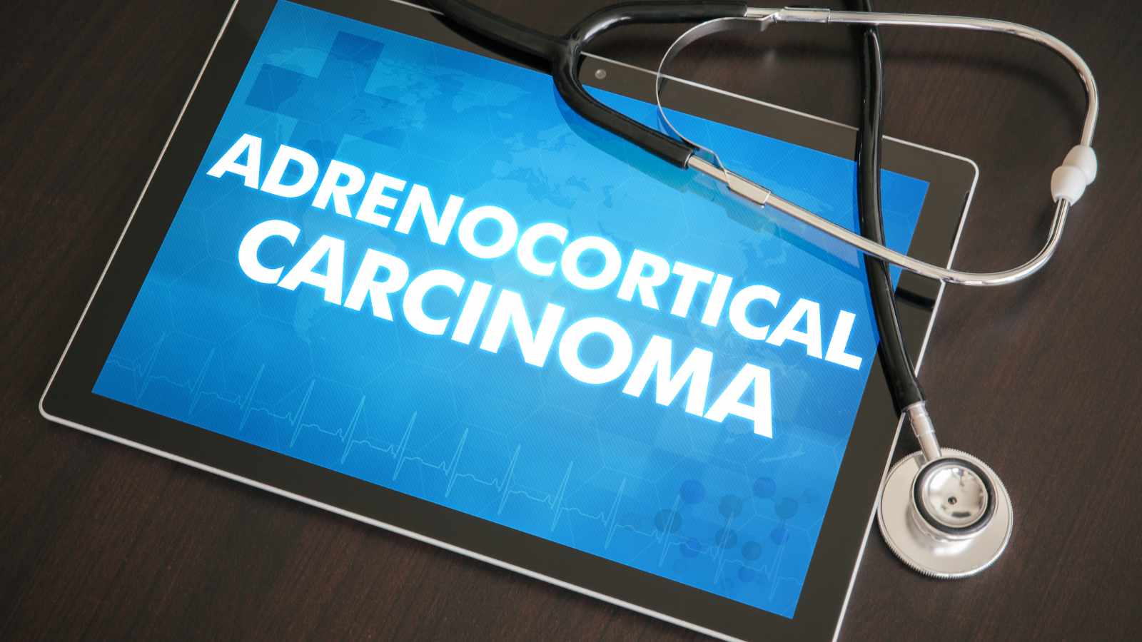 Adrenocortical Carcinoma