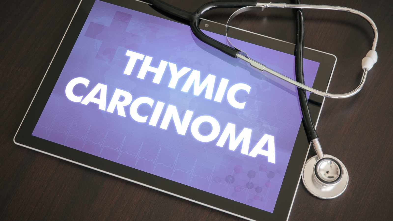 Thymoma and Thymic Carcinoma