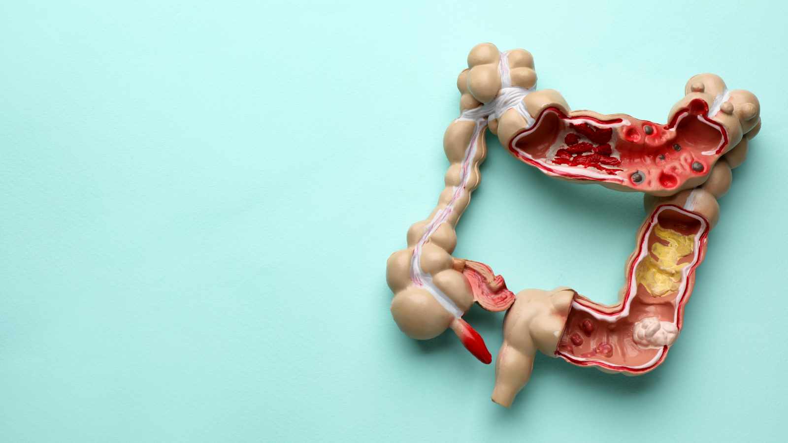 large intestine