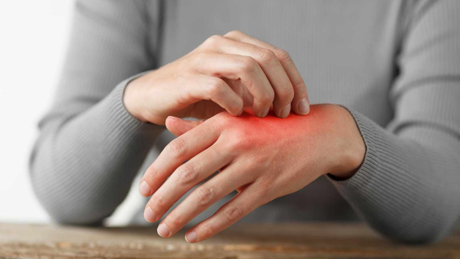 skin irritation on palm