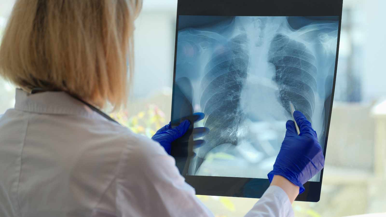 Doctor diagnosing lung disease